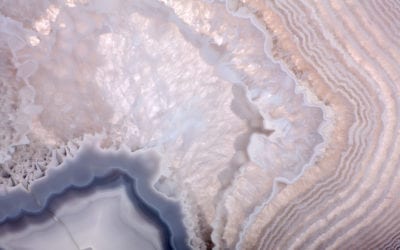 Mineral Dynamics and the Stress Response in Migraine