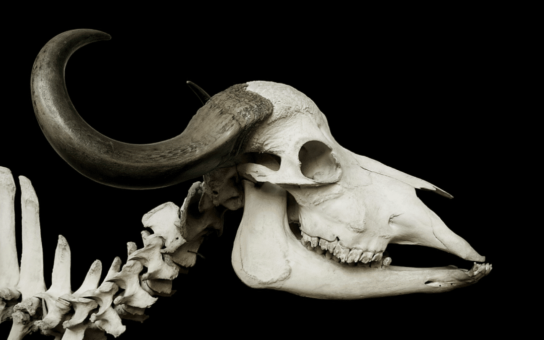 Does Bone Health Play a Role in Migraine?