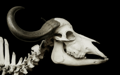 Does Bone Health Play a Role in Migraine?